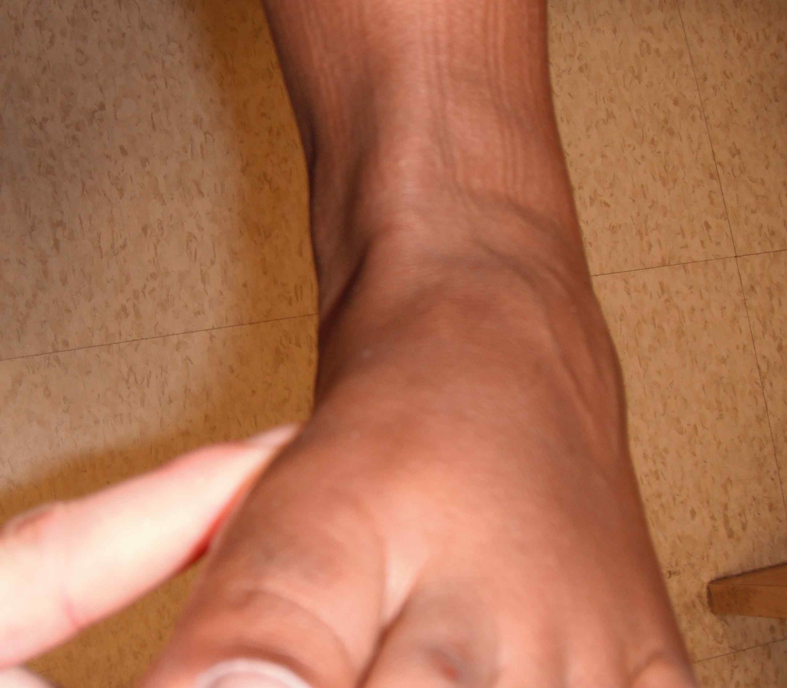 Foot Exam Tibialis Anterior
